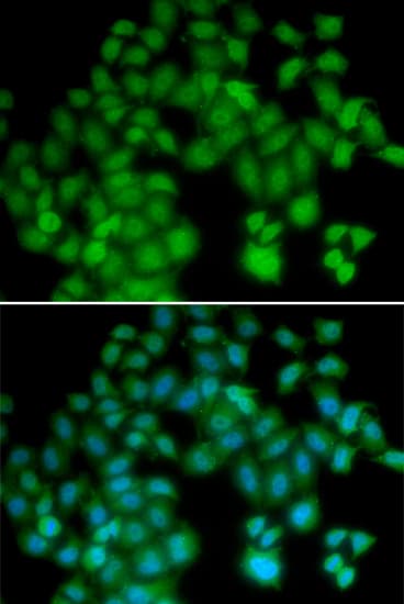 TMSB4X / Thymosin Beta-4 Antibody