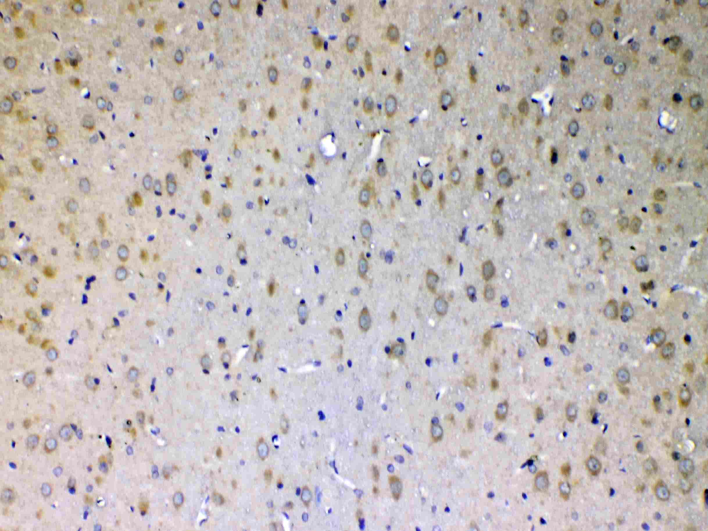 ERBB4 / HER4 Antibody