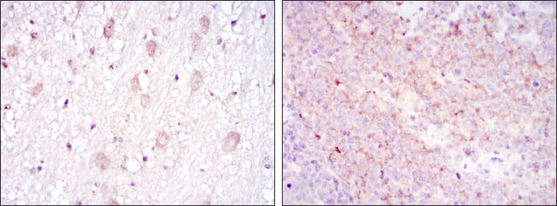 CD1A Antibody (clone 7A7)