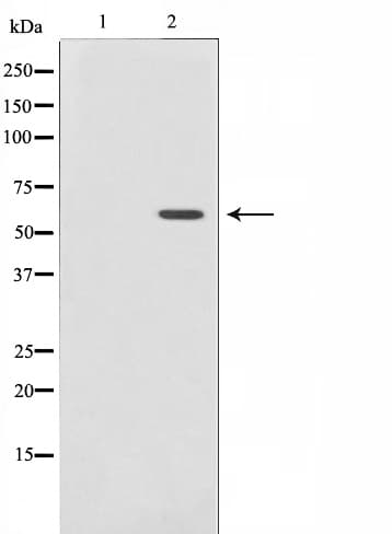 AKT1 Antibody (phospho-Thr308)