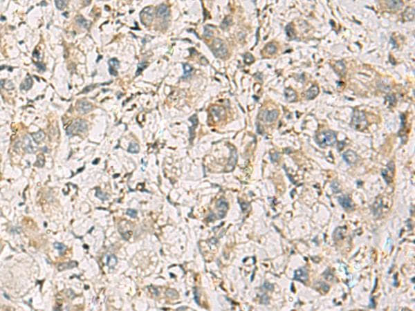 CMTM1 Antibody