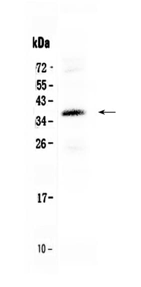 CRD / CRX Antibody