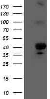 HMOX2 / Heme Oxygenase 2 Antibody (clone OTI4E10)