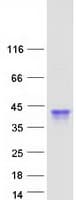 Human OBP2B Protein (Recombinant Myc-DDK (Flag))