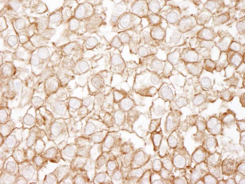 EEF2 / Elongation Factor 2 Antibody (aa808-858)
