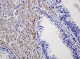 FNDC4 Antibody (clone OTI1B7)