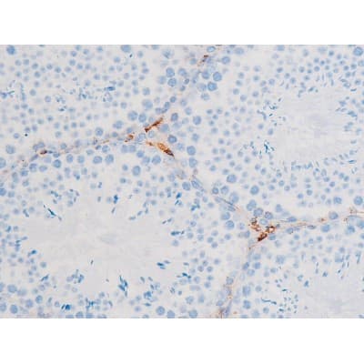 PRKCQ / PKC-Theta Antibody (phospho-Ser676)