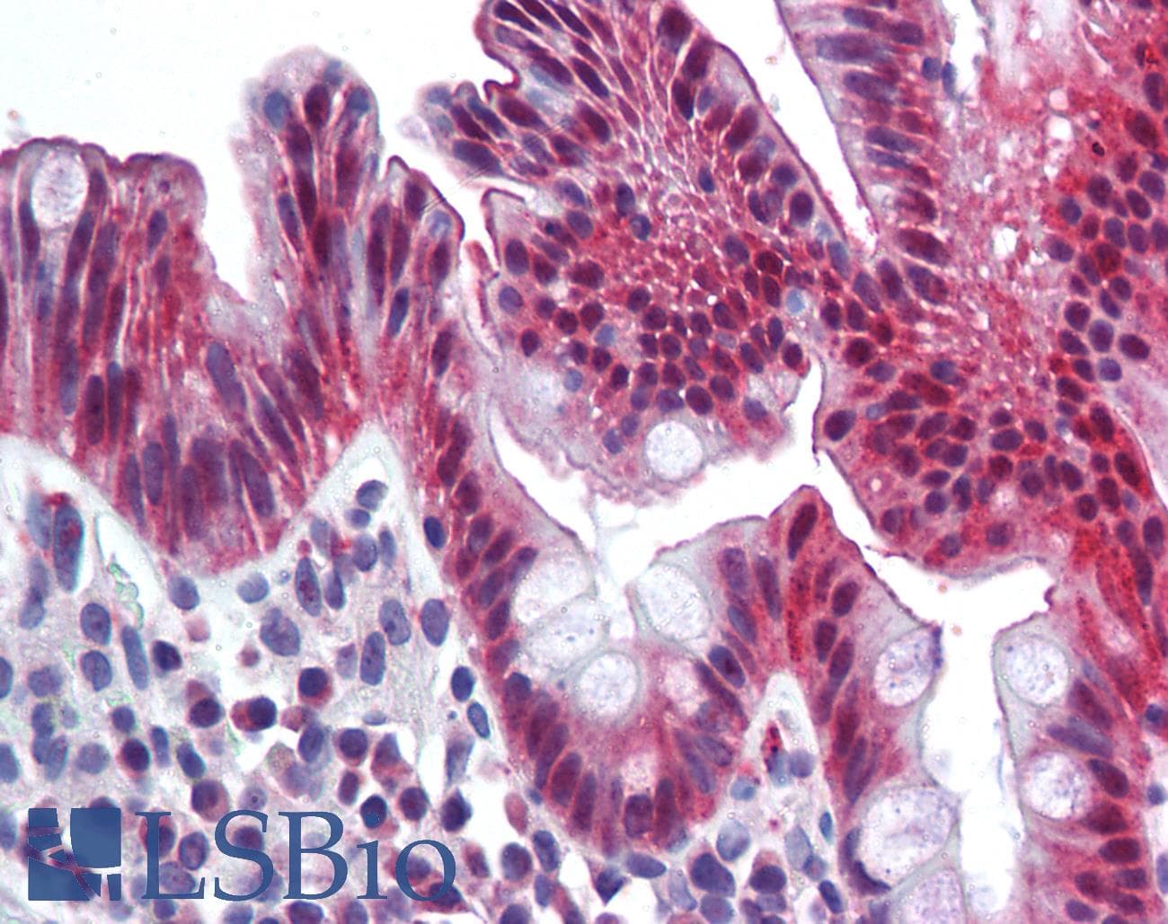 IHC-plus™ CD66a / CEACAM1 Antibody (Internal)