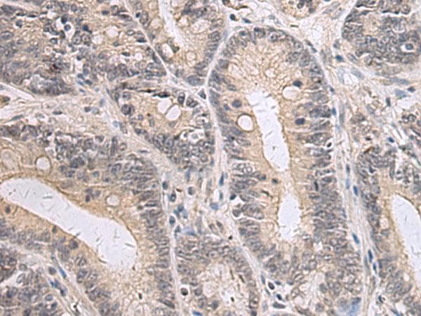 PPM1K Antibody