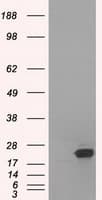 SSX2 Antibody (clone OTI4A11)