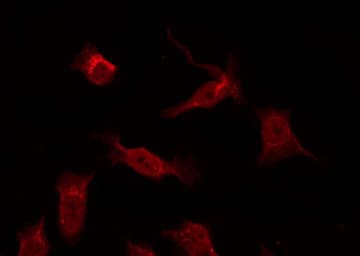 Polyclonal Rabbit anti-Human TRADD Antibody (IHC, IF, WB)