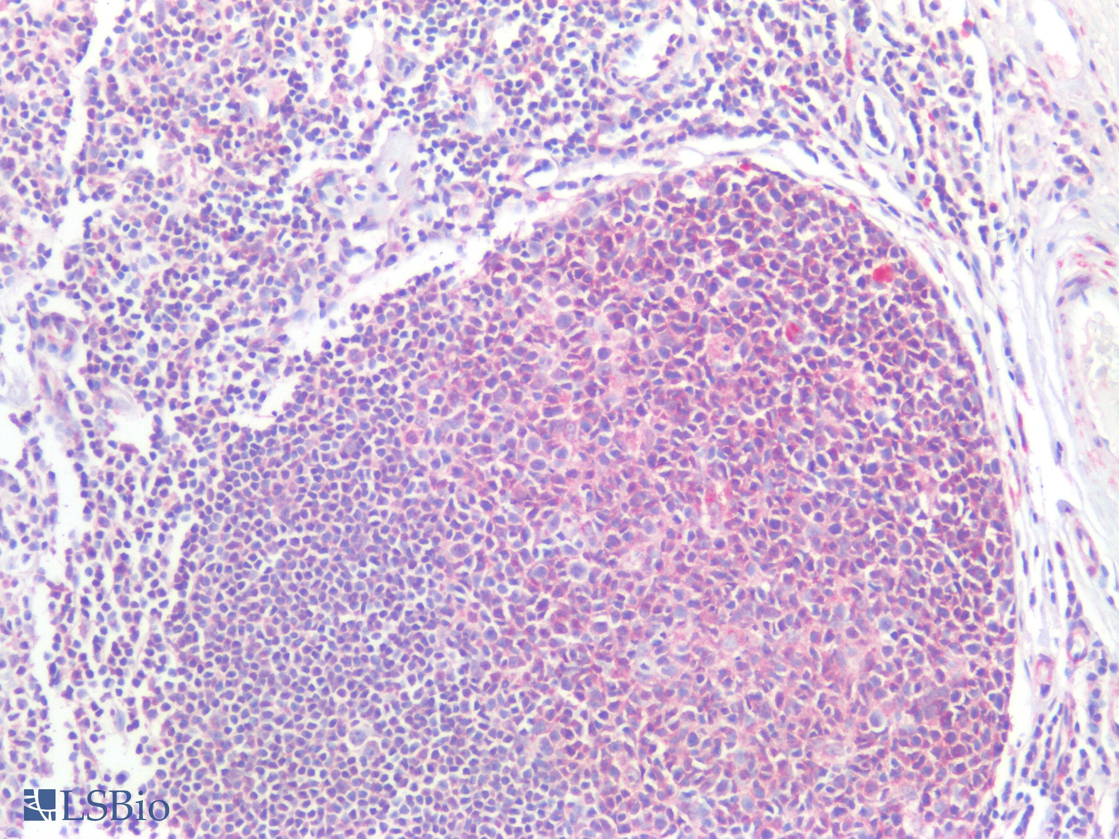 IHC-plus™ PD-L2 / PDCD1LG2 / CD273 Antibody