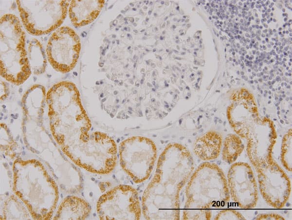 RASGRP4 Antibody (clone 6D3)