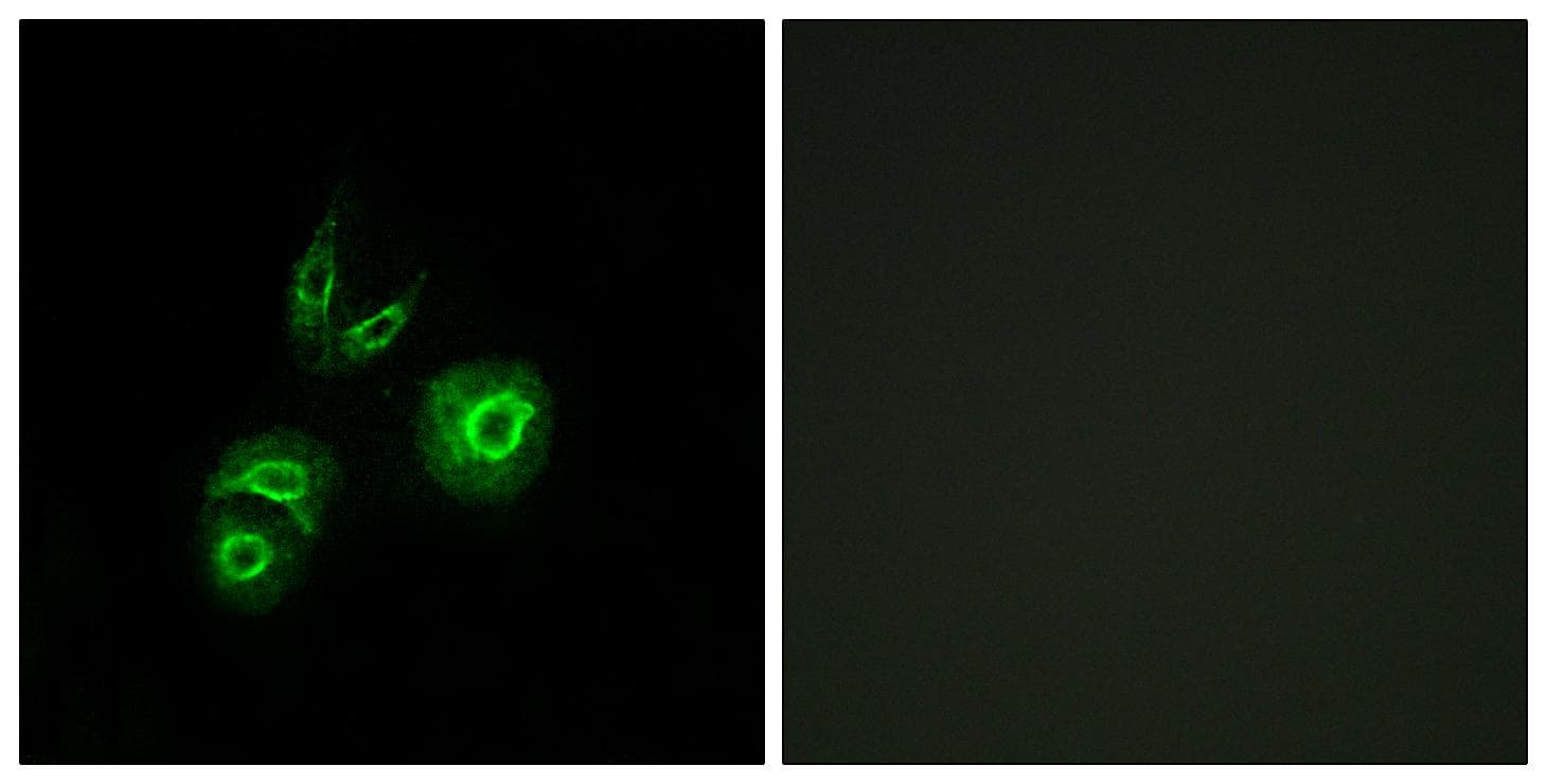 Polyclonal Rabbit anti-Human c-Met Antibody (IF)