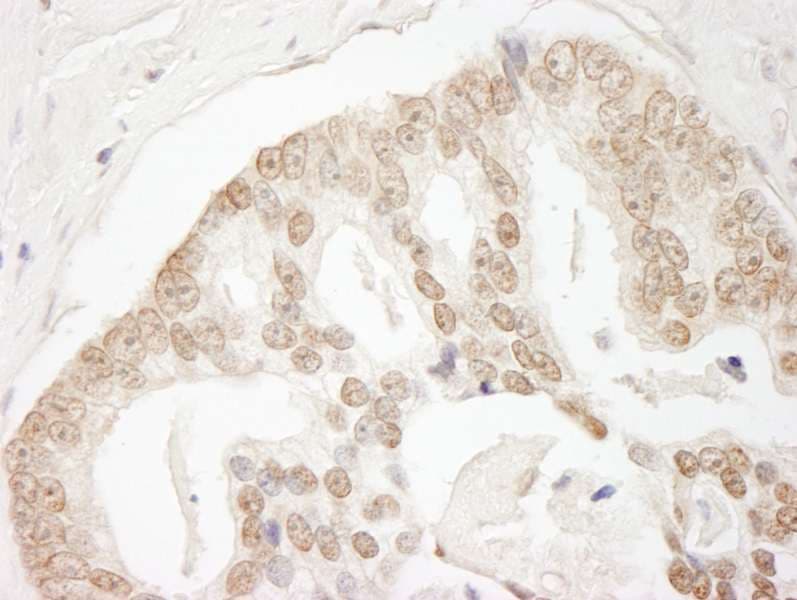 GIT2 Antibody (aa500-550)