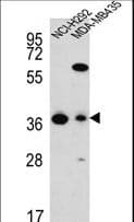FAHD2A Antibody (aa272-300)