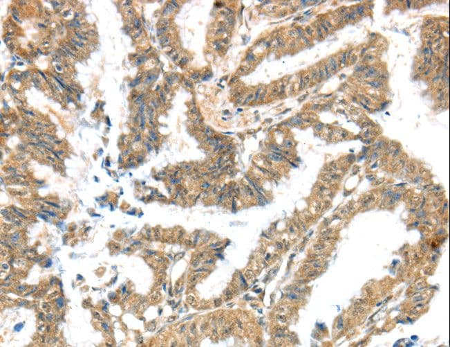 Kv10.1 / KCNG3 Antibody