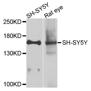 ADCY2 / Adenylate Cyclase 2 Antibody