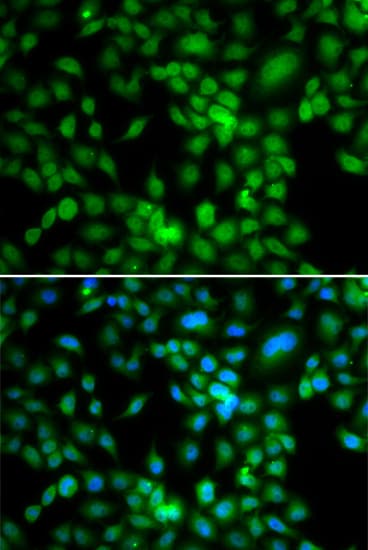 Polyclonal Rabbit anti-Human SYCE1 Antibody (IHC, IF, WB)
