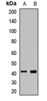 Polyclonal Rabbit anti-Human IL2RG / CD132 Antibody (WB)