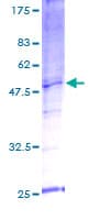 Human SNX21 Protein (Recombinant GST)