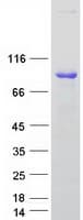 Human ARHGEF7 Protein (Recombinant Myc-DDK (Flag))