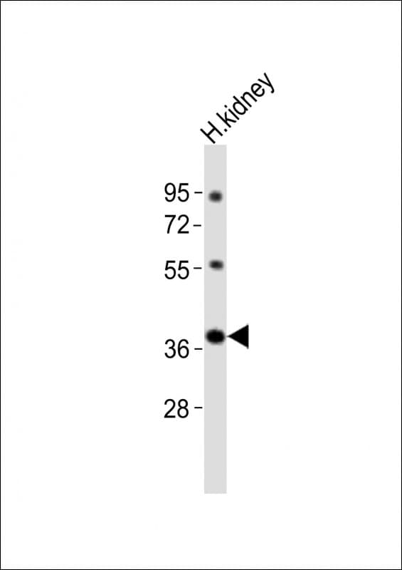 NPY2R Antibody (aa23-59)