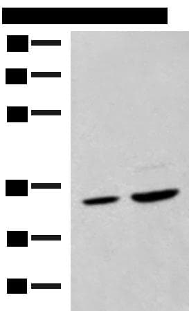 Polyclonal Rabbit anti-Human SCGN / Secretagogin Antibody (WB)