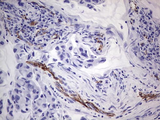 Monoclonal Mouse anti-Human CD144 / CDH5 / VE Cadherin Antibody (clone OTI1F4, aa48-333, IHC, WB)