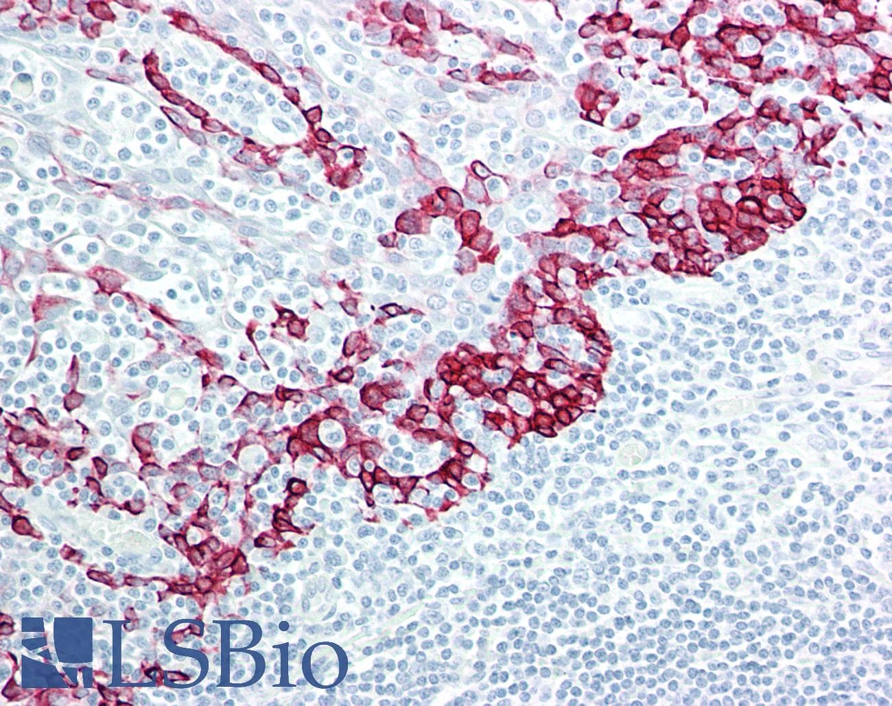 PathPlus™ Monoclonal Mouse anti-Human KRT15 / CK15 / Cytokeratin 15 Antibody (IHC, WB)