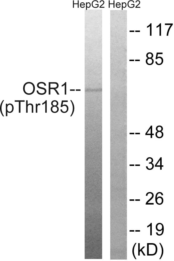 Polyclonal Rabbit anti-Human OXSR1 / OSR1 Antibody (phospho-Thr185, IHC, WB)