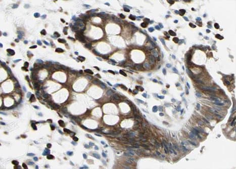 APC Antibody (phospho-Ser2054)