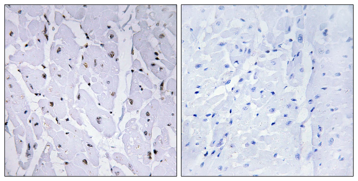 Polyclonal Rabbit anti-Human MYB / c-Myb Antibody (phospho-Ser12, IHC, WB)