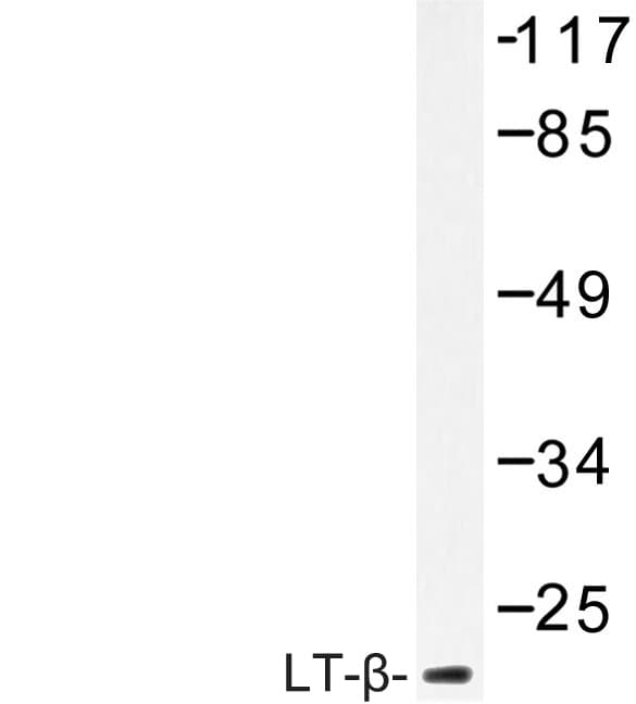 Lymphotoxin-Beta / LTB Antibody (Val211)