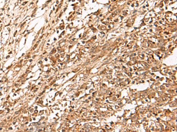 ZBTB43 Antibody