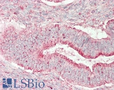 IHC-plus™ UPF3B Antibody (aa433-483)