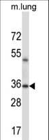 ERCC1 Antibody (aa268-297)