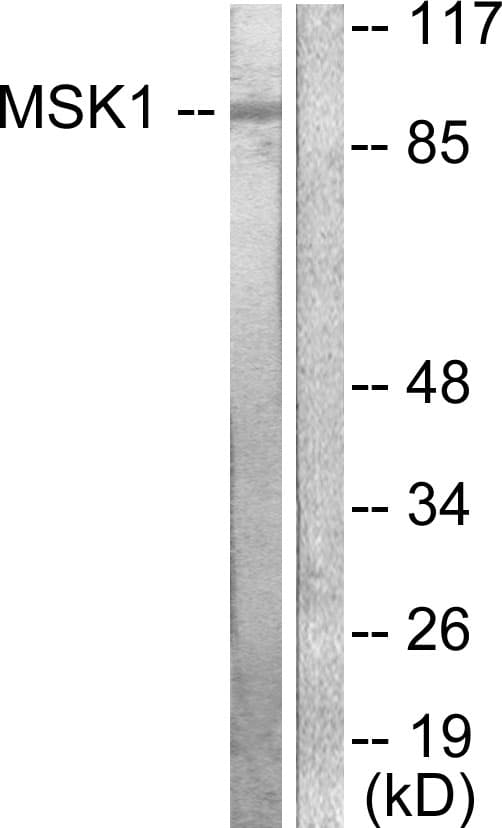 IHC-plus™ RPS6KA5 / MSK1 Antibody (aa551-600)
