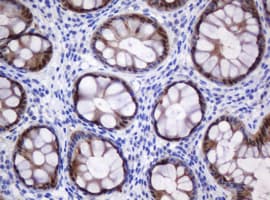 CMPK / CMPK1 Antibody (clone OTI2A2)