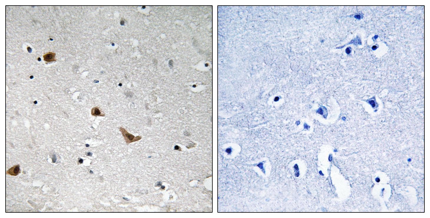 IKBKG / NEMO / IKK Gamma Antibody (phospho-Ser376)