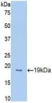 PROCR / EPCR Antibody (aa32-167)