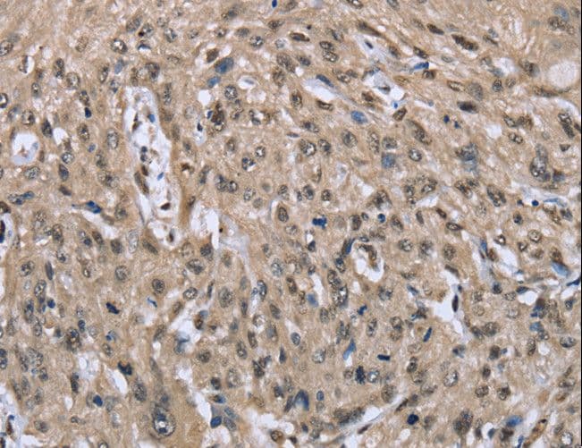 DYNLL1 / PIN Antibody