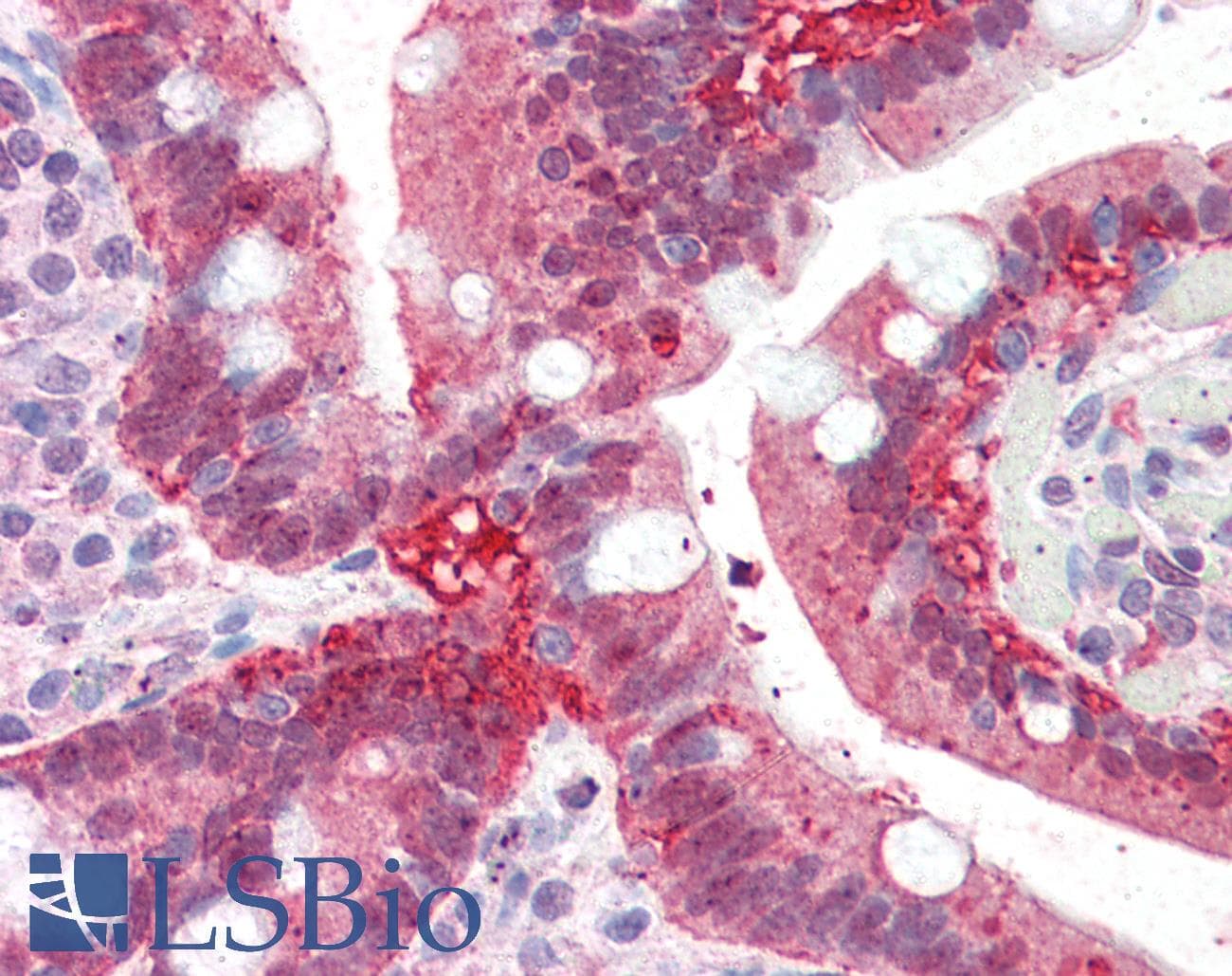 IHC-plus™ DDX / AKR1C3 Antibody (aa311-323)