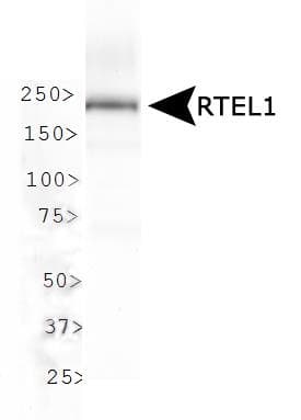 RTEL1 Antibody (aa800-1000)