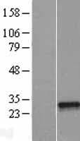 NFYB Protein (Over-Expression Lysate Myc-DDK (Flag))