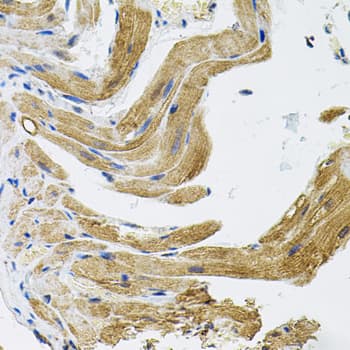 Polyclonal Rabbit anti-Human TRPC1 Antibody (IHC, WB)