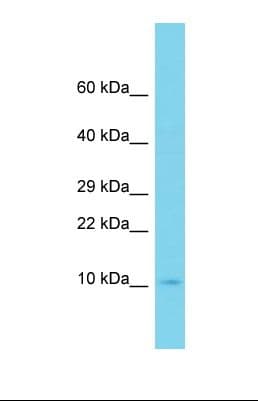 Polyclonal Rabbit anti-Human UBE2D4 Antibody (C-Terminus, WB)