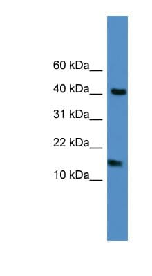 LCN1 / Lipocalin-1 Antibody (C-Terminus)