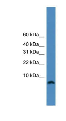PCNA-Associated Factor Antibody (N-Terminus)