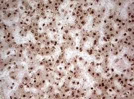 Monoclonal Mouse anti-Human NUMB Antibody (clone OTI2F1, aa1-365, IHC, WB)